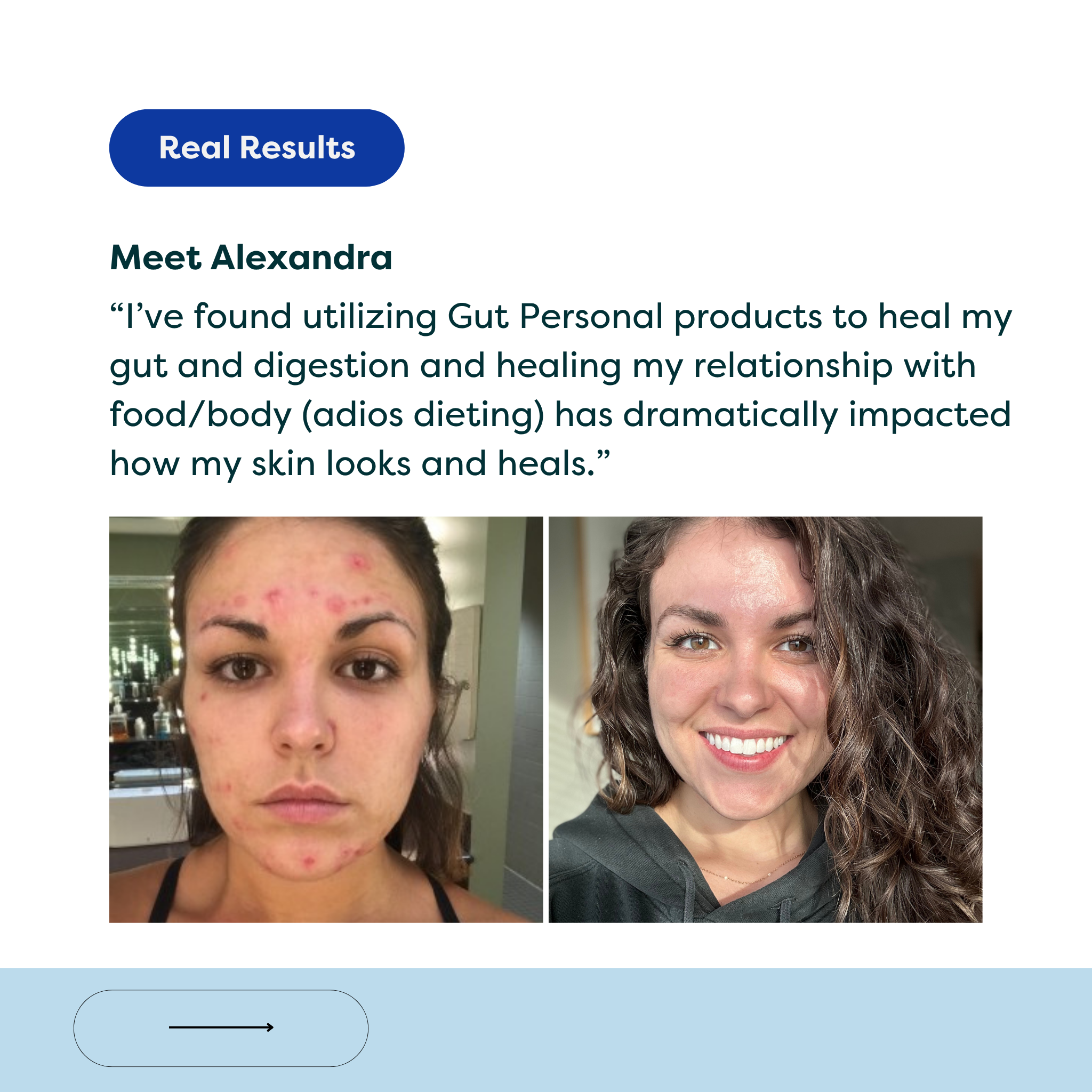 The Gut + Skin Probiotic (formally the Healer + Probiotics)