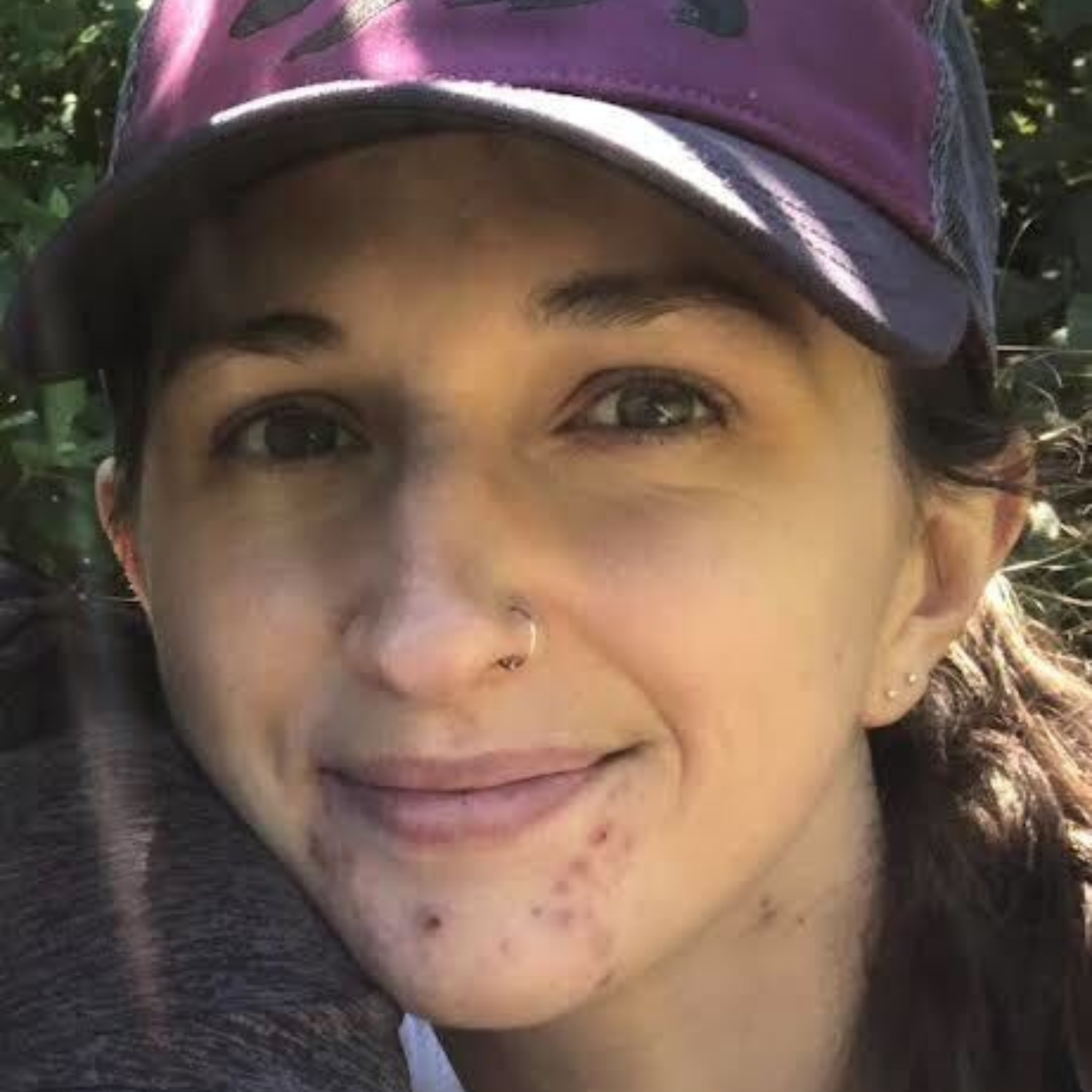 image of women with acne