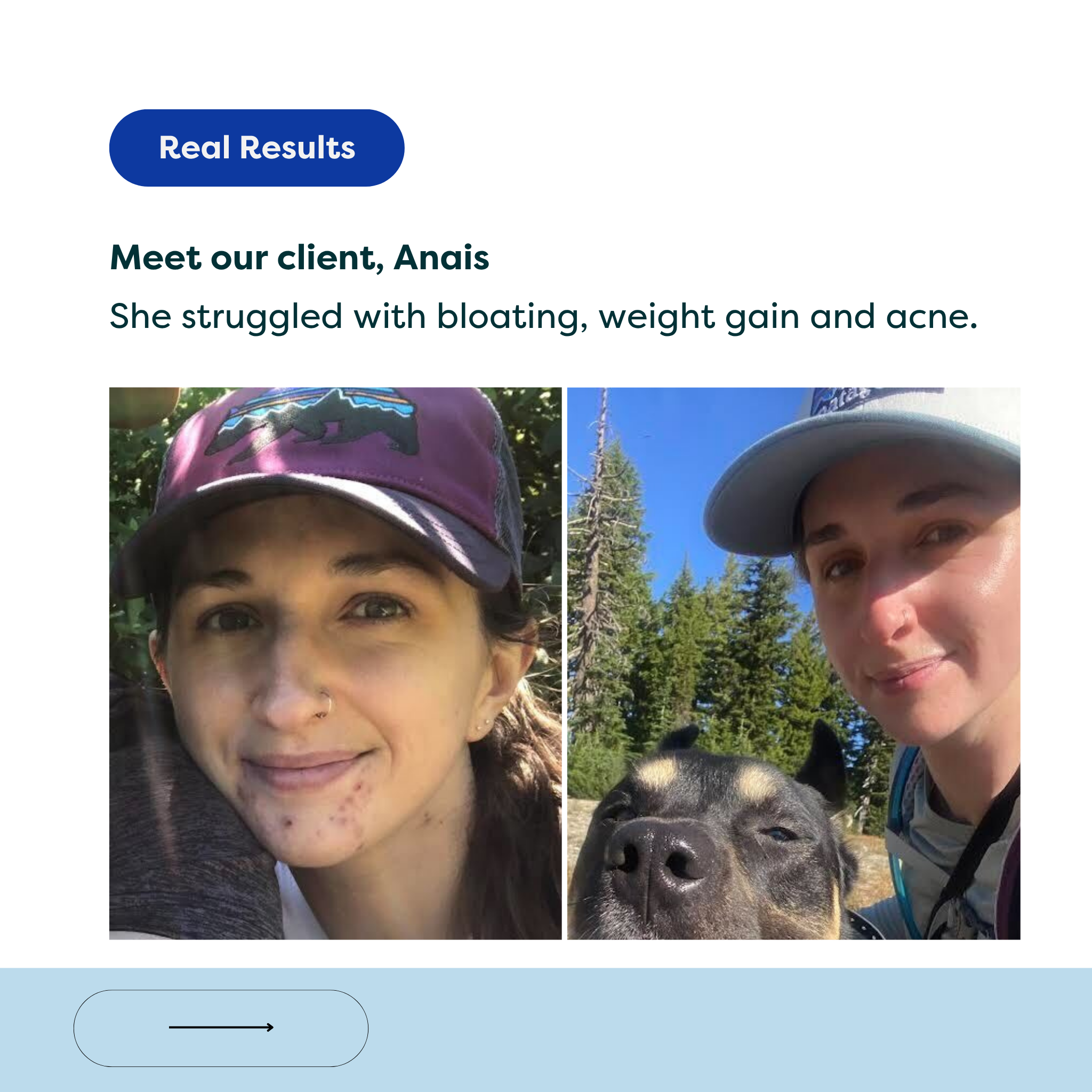 The Gut + Skin Probiotic (formally the Healer + Probiotics)