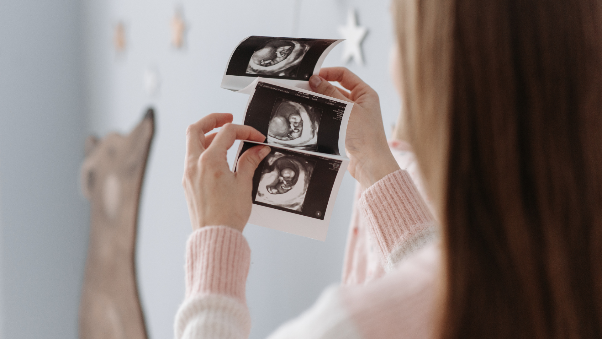 Choosing the Right Prenatal Supplement: Key Factors to Consider
